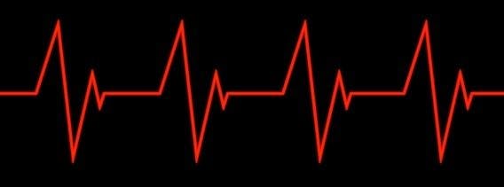 My heart was beating correctly now and I was left with wires sticking out of my chest.